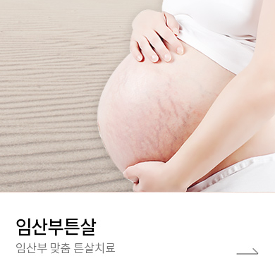 임산부튼살